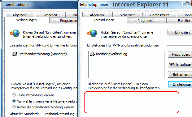 Internet Explorer 11 hat keine Verbindungsoptionen